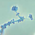 From Spore to Symbiosis: How Mycorrhizal Fungi Find Their Hosts?, Britt A. Bunyard